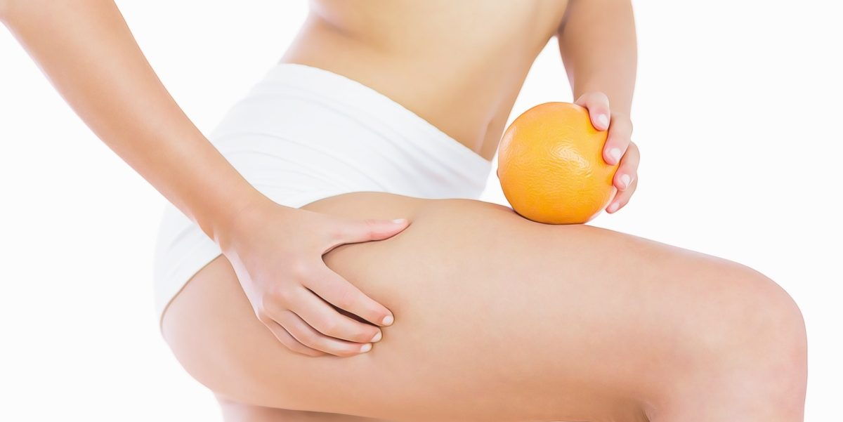 4 remedios naturales para disminuir la celulitis