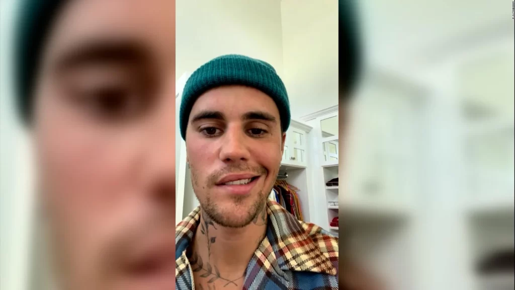Justin Bieber mejora luego de la parálisis facial